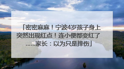 密密麻麻！宁波4岁孩子身上突然出现红点！连小便都变红了……家长：以为只是摔伤